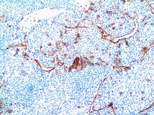 IHC of Claudin-5 on an FFPE Liver Tissue